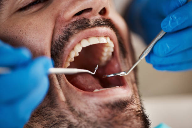 Best Emergency Denture Repair in Butler, PA